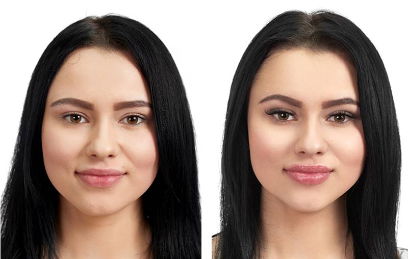 Before & After Results- Discover the Key to Transformation | Dr. Surabhi Sharma 