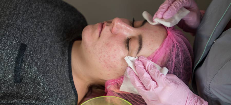 Chemical Peel Treatment in Kolkata | Dr. Surabhi Sharma 