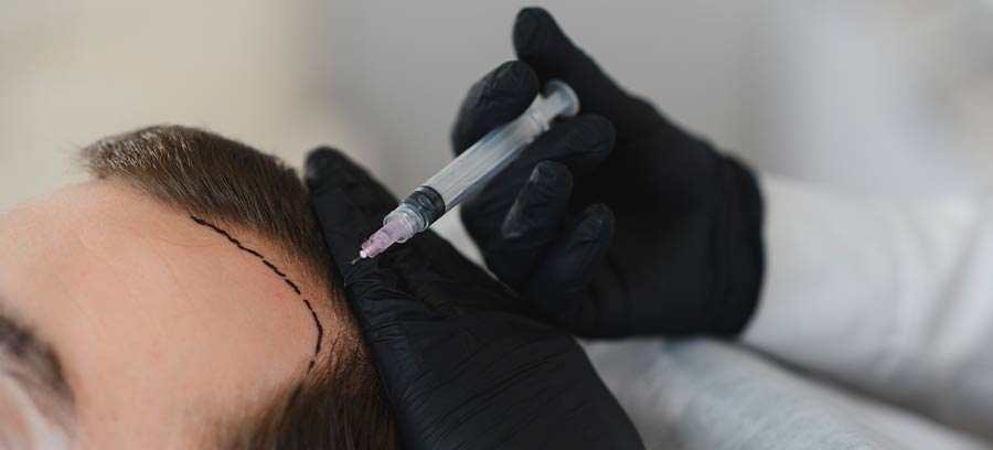 Hair Transplant in Kolkata | Dr. Surabhi Sharma 